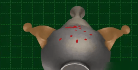 \